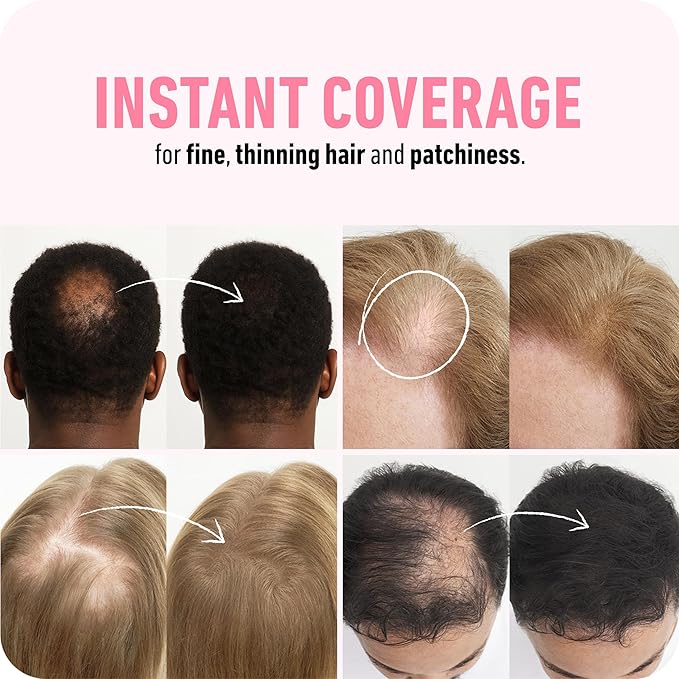BOLDIFY Hair Fibers (56g) Fill In Thinning and Fine Hair (White)
