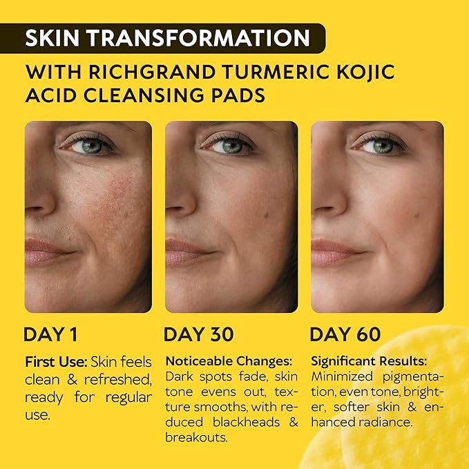 Turmeric Kojic Acid Cleansing Pads